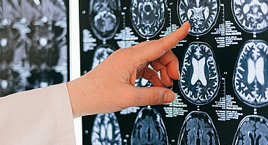 Uzmanlar uyarıyor! Yaşam tarzı alışkanlıkları Alzheimer riskini artırabilir