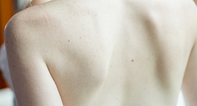 Bel fıtıklarında erken iyileşme mümkün olabiliyor